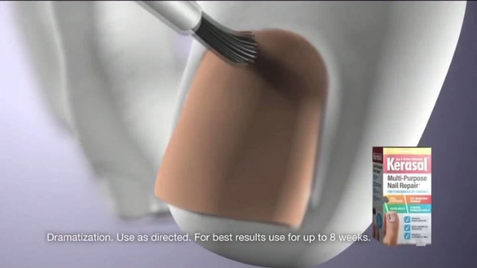 Kerasal Commercial